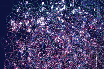 Human Breast Cancer - 10X Genomics copyright